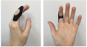 Oval 8 splint for dorsal.png