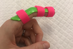 Dorsal finger splint.png