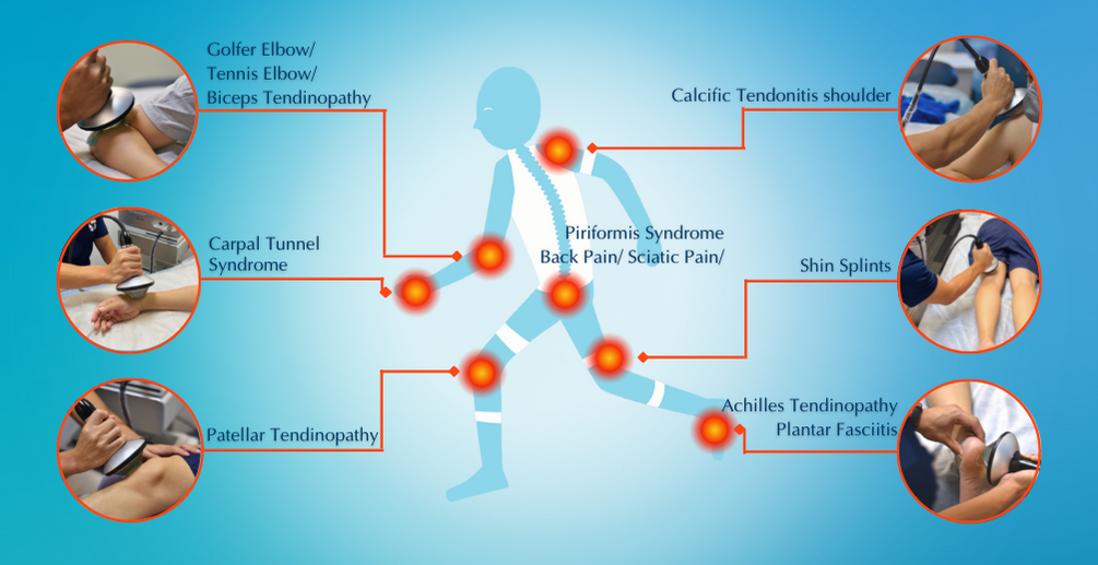 focus shockwave therapy services.png