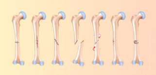 SP-health corner (8).png